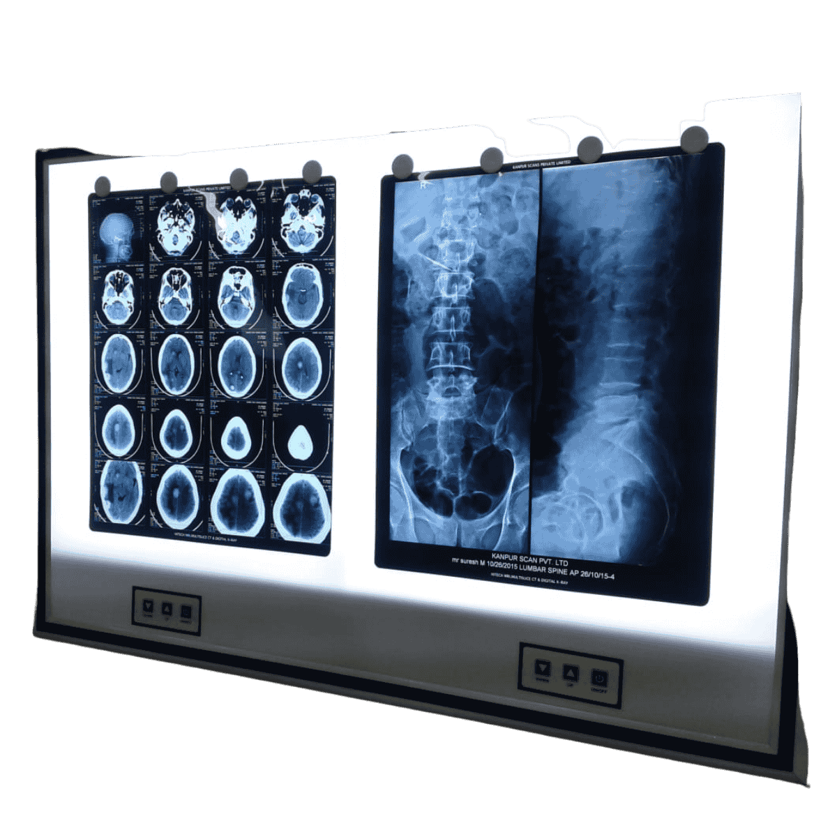 LED X-Ray Viewer